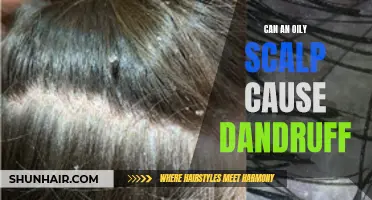 Understanding the Link between Oily Scalp and Dandruff: Unraveling the Relationship