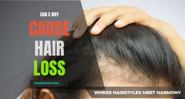 Understanding the Relationship Between C Diff and Hair Loss