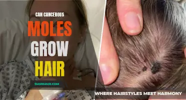 Exploring the Link Between Cancerous Moles and Hair Growth