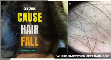 Understanding the Link Between Celiac Disease and Hair Loss