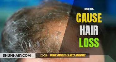 Unraveling the Connection: Investigating the Link Between CFS and Hair Loss