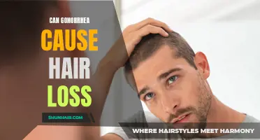 Can Gonorrhea Lead to Hair Loss: Fact or Fiction?