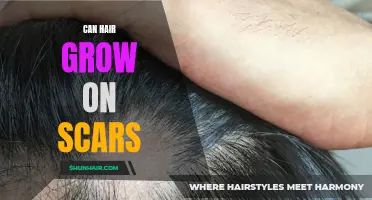 Can Hair Grow on Scars: Understanding the Hair Growth Process on Scarred Skin