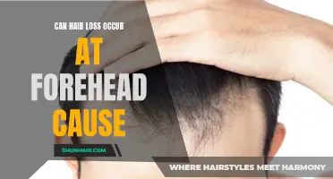 Understanding How Hair Loss at the Forehead Can Cause Issues