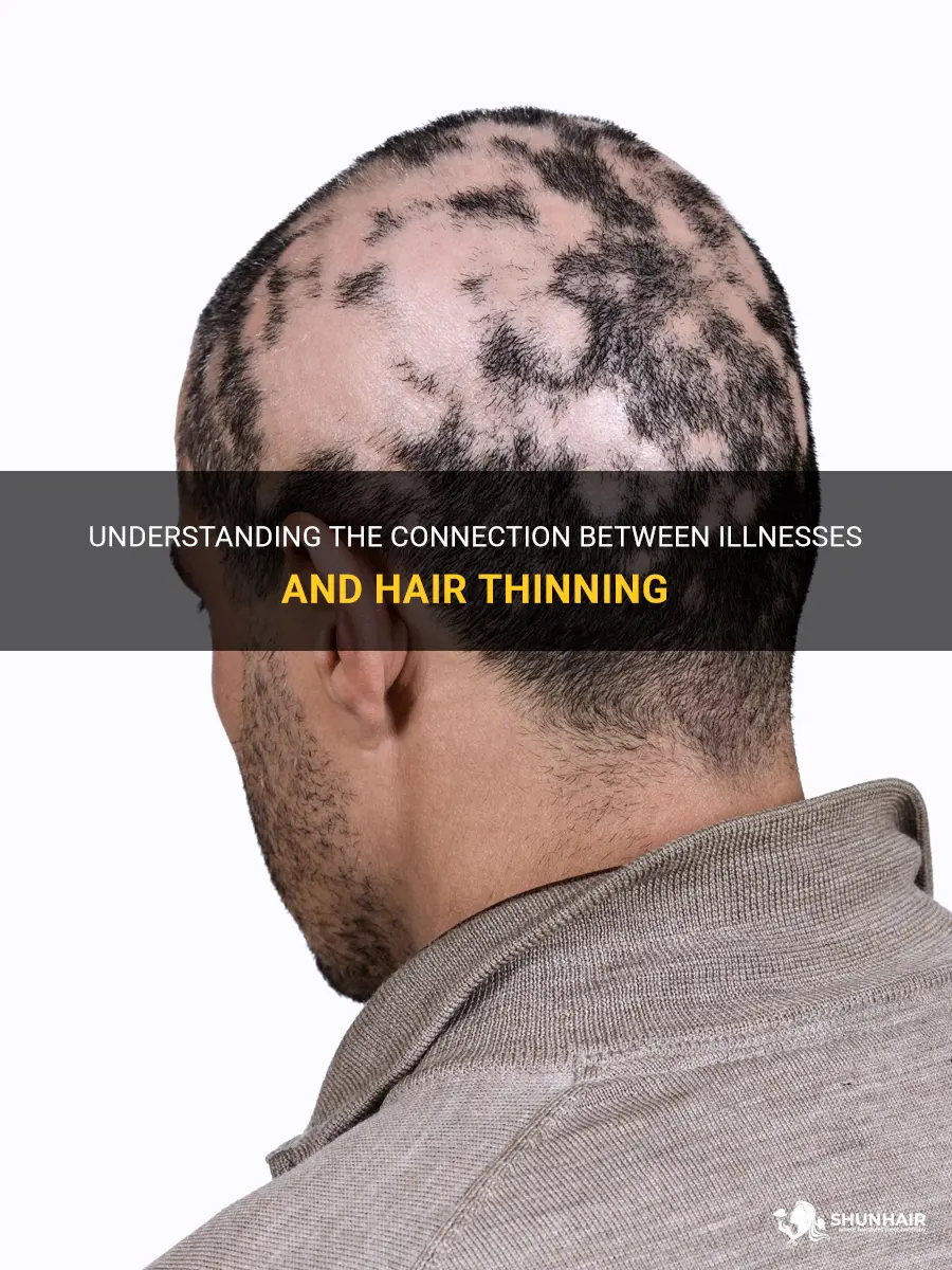 can hair thinning be due to an illness