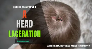 Using Shampoo with a Head Laceration: What You Need to Know