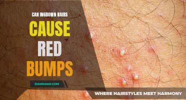 Can Ingrown Hairs Cause Painful Red Bumps?