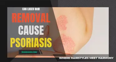 Addressing the Link Between Laser Hair Removal and Psoriasis