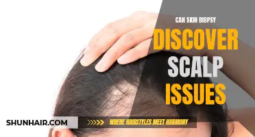 The Benefits of Skin Biopsy in Uncovering Scalp Issues