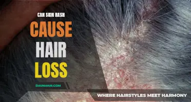 Can Skin Rash Lead to Hair Loss? Discover the Connection