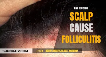 Does Touching the Scalp Cause Folliculitis?