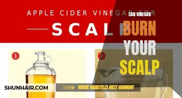 Can Vinegar Cause Burns on Your Scalp?