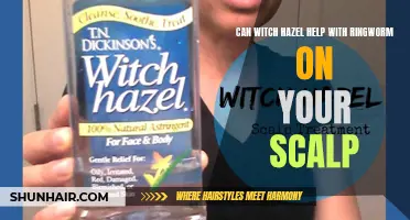 How Witch Hazel Can Help Treat Ringworm on Your Scalp