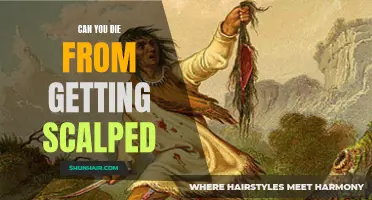 Survival Chances: Exploring the Extent of Scalping Injuries