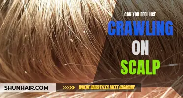 Understanding the Sensations: Can You Feel Lice Crawling on Your Scalp?