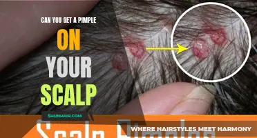 Understanding Scalp Breakouts: Can You Get Pimples on Your Scalp?