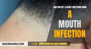 Exploring the Link Between Mouth Infections and Scalp Infections: Can One Lead to the Other?
