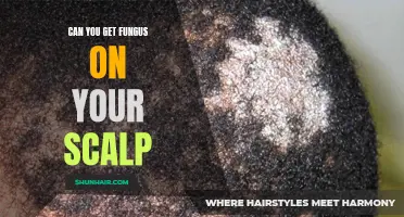 Understanding the Causes and Treatments for Fungal Infections on the Scalp