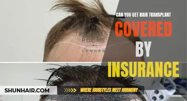 Is Hair Transplant Covered by Insurance?