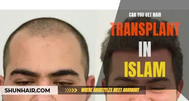 Can You Get a Hair Transplant in Islam?