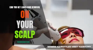 Exploring Laser Hair Removal for the Scalp: What You Need to Know