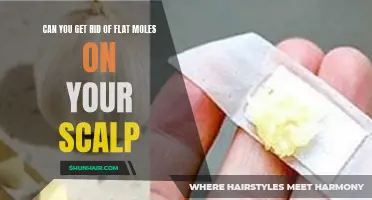 Ways to Eliminate Flat Moles on Your Scalp