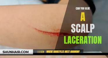 Can You Use Glue to Close a Scalp Laceration?