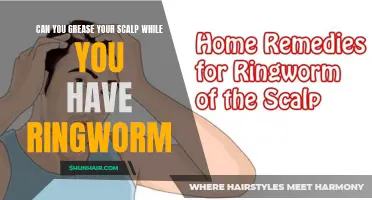 Managing Ringworm: Can Greasing Your Scalp Help or Hinder?