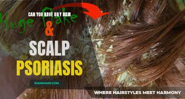 Oily Hair and Scalp Psoriasis: Managing the Double Trouble