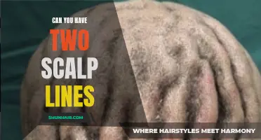 Understanding Multiple Scalp Lines: Can You Have Two?