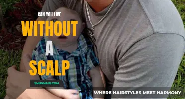 The Importance of a Scalp: Can You Really Live Without It?