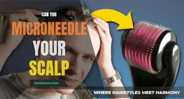 Unlocking the Growth Potential: Microneedling for a Healthier Scalp