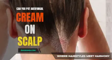 How to Effectively Use Antifungal Cream on the Scalp for Hair Health