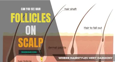 Can You Spot Hair Follicles on Your Scalp?