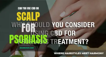 Using CBD on Scalp for Psoriasis: A Natural Remedy to Consider