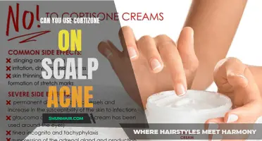 Can Cortizone Cream Help Treat Scalp Acne?