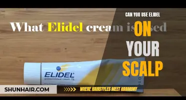 Can You Safely Use Elidel on Your Scalp?