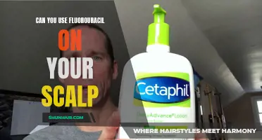 5 Things You Should Know About Using Fluorouracil on Your Scalp