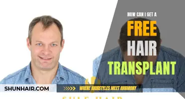 How to Get a Hair Transplant for Free: A Complete Guide