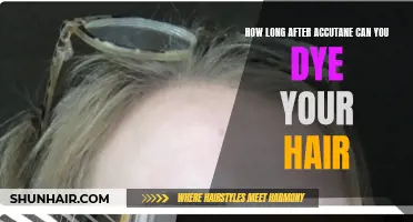 The Effects of Accutane on Hair Dyeing and How Long to Wait