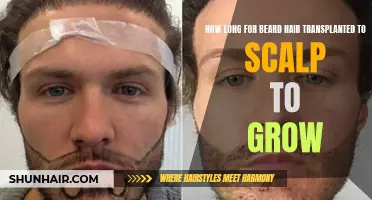 The Growth Timeline: How Long Does it Take for Beard Hair Transplanted to the Scalp to Grow?