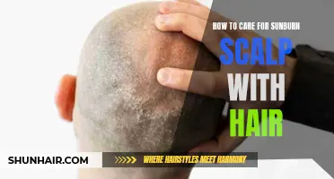 Effective Ways to Care for a Sunburned Scalp with Hair