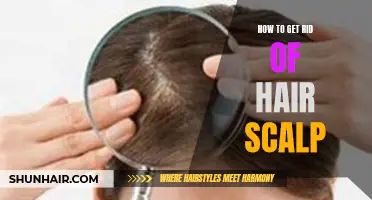 Tips for Eliminating Hair Scalp Problems
