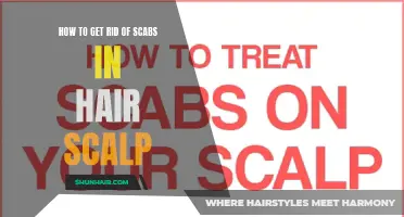 Effective Ways to Remove Scabs from Your Hair Scalp