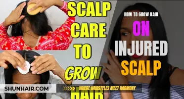 Tips for Regrowing Hair on an Injured Scalp
