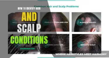 Understanding the Different Hair and Scalp Conditions: A Guide for Identifying and Treating Them