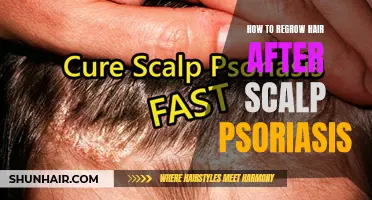 Tips for Regrowing Hair After Scalp Psoriasis