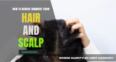 Effective Ways to Remove Dandruff from Hair and Scalp