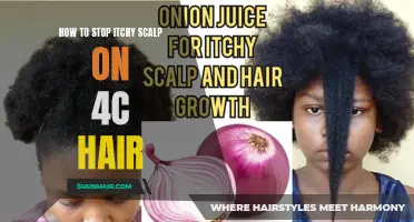 Effective Home Remedies for Alleviating Itchy Scalp on 4C Hair