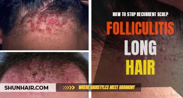 Tips for Preventing Recurrent Scalp Folliculitis in Long Hair